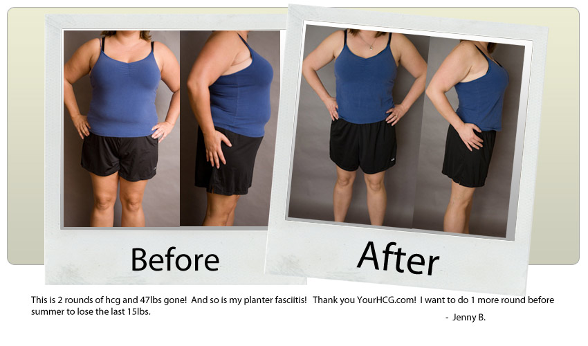 hcg diet testimonial hcg diet testimonials